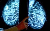 Breast screening uptake in Greater Preston remains below pre-pandemic levels, new figures show
