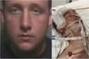 Scott Sutcliffe left Lee Burns with a fractured skull and two bleeds on the brain (Credit: Lancashire Police)