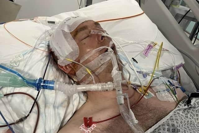 Lee had to undergo a life-saving operation following the attack in Poulton