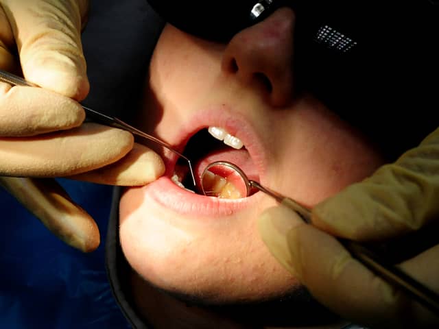 There were more than 1,100 hospital admissions in Lancashire to remove children's decaying teeth (Credit: PA)