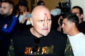 John Fury, father of boxer Tyson Fury, with blood on his face during a media day in Riyagh. 