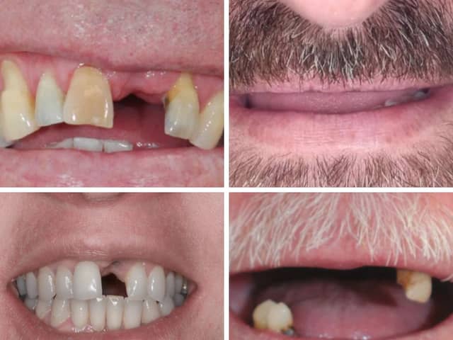 More than 100 people have submitted pictures of their teeth, or lack of, in the hope of getting a new set for free. 