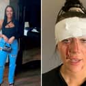 The family of Kiena Dawes released images of the 23-year-old following her death and claimed she took her own life after she was repeatedly assaulted by an ex-partner