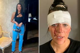 The family of Kiena Dawes released images of the 23-year-old following her death and claimed she took her own life after she was repeatedly assaulted by an ex-partner