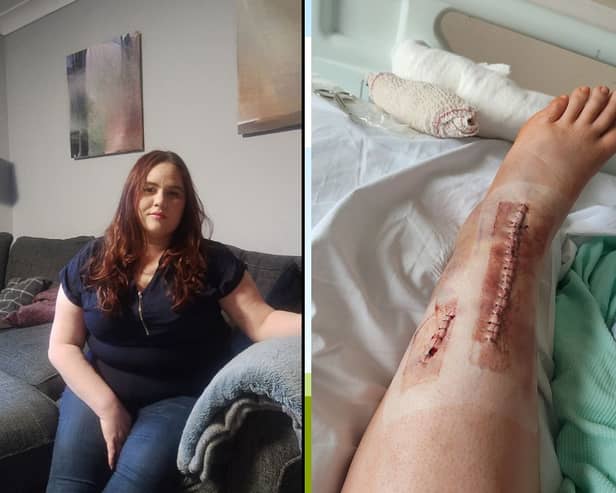 Jodie Wright says she was left screaming in agony after snapping her leg at Preston's Flip Out trampoline park.