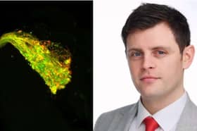 Dr Anthony Aggidis and the brain of a fruit fly with Tau expressed in a neuronal circuit used by the fly in olfactory memory. The red shows where Tau is building up in clusters along the neurons
