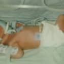 The parents of a man who was left severely disabled at birth have been awarded £9 million in compensation
