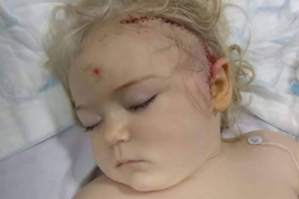 Poppy Sinnott was diagnosed with a life-threatening brain tumour after experiencing seizures