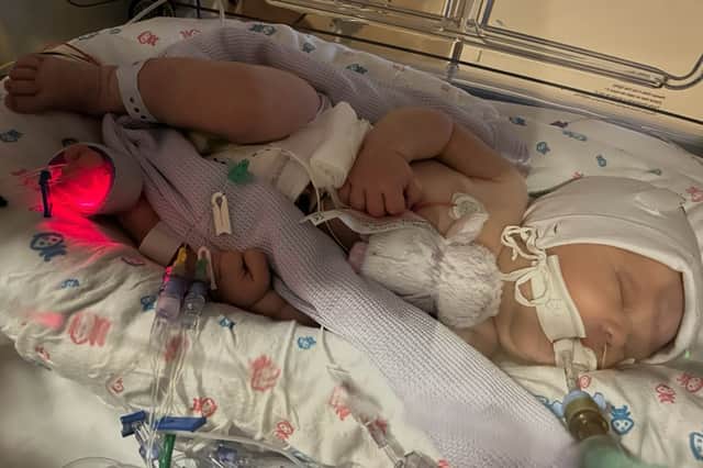 Ayla was born “pale, floppy and not breathing” at Blackpool Victoria Hospital. She suffered seizures and her care was transferred to Royal Preston Hospital, where she died two weeks later in Shannon’s arms