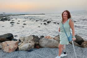 Gill Haddington chose to have her right hand amputated after a one-inch-long dog scratch left her in agony