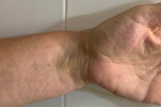 Some of the injuries the woman sustained from her fall