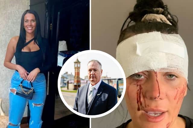 Police boss inspired by Kiena Dawes case to change law on domestic abuse deaths