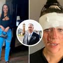 Police boss inspired by Kiena Dawes case to change law on domestic abuse deaths