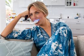 Why the SmilePro teeth whitening is winning over customers including me (aff)