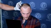Patient during examination before hair transplant