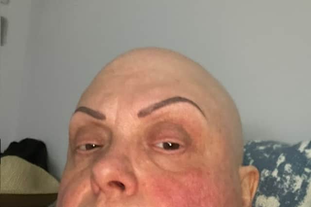 Chemotherapy left Michelle unable to leave the house some days.