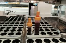 Blood testing across East Lancashire has been badly affected by the ongoing dispute