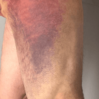 Police officer dragged along road by car after attempting to arrest suspected drug dealer