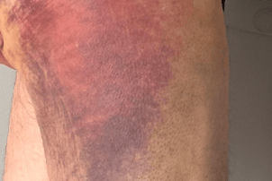 Police officer dragged by car during drug investigation in Nelson