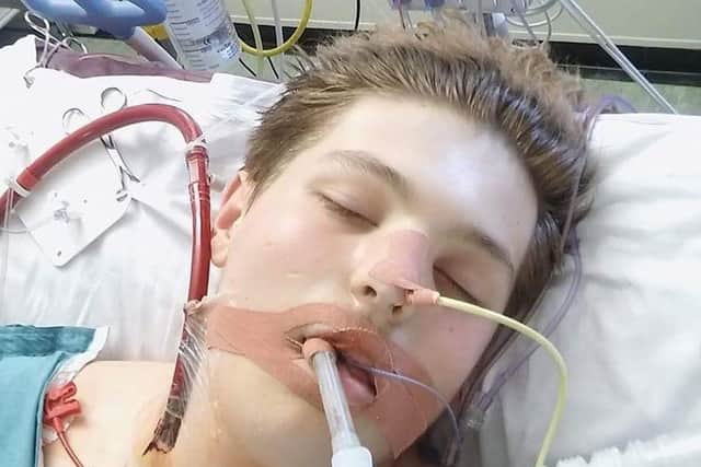Ewan Fisher, 18, who was treated for hypersensitivity pneumonitis at Glenfield Hospital in Leicester