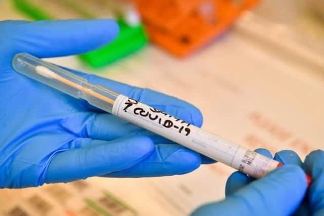 The rate of infection is higher in the North West than anywhere else in England.