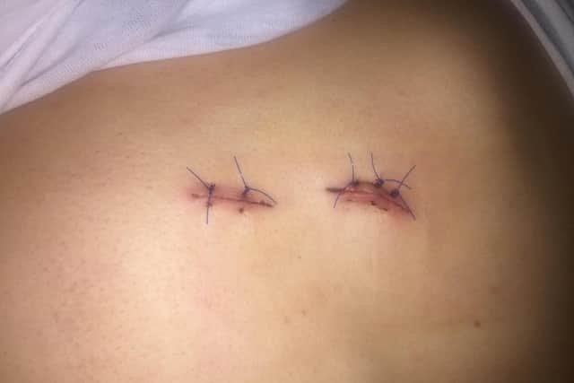 Eve's scars after medics cleaned and stitched them