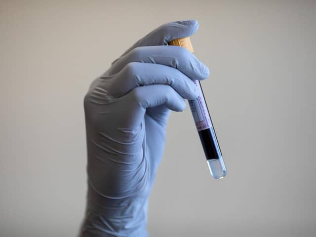 A blood sample is held during a Covid-19 antibody testing program