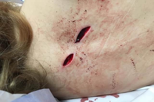 Eve suffered two horrific knife wounds in a Preston park