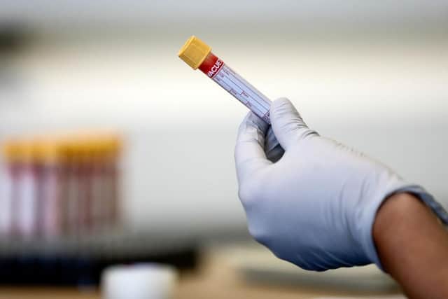 A total of 613 positive Covid cases have been recorded in Burnley since the start of thepandemic. Photo: Getty