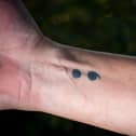 Alan's semi-colon tattoo symbolises suicide bereavement.