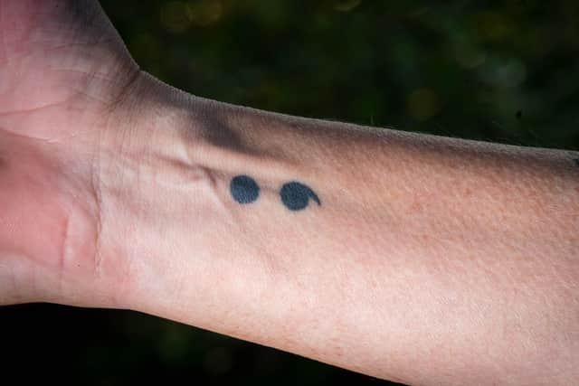 Alan's semi-colon tattoo symbolises suicide bereavement.