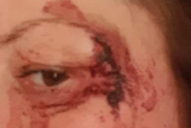 The woman's injuries