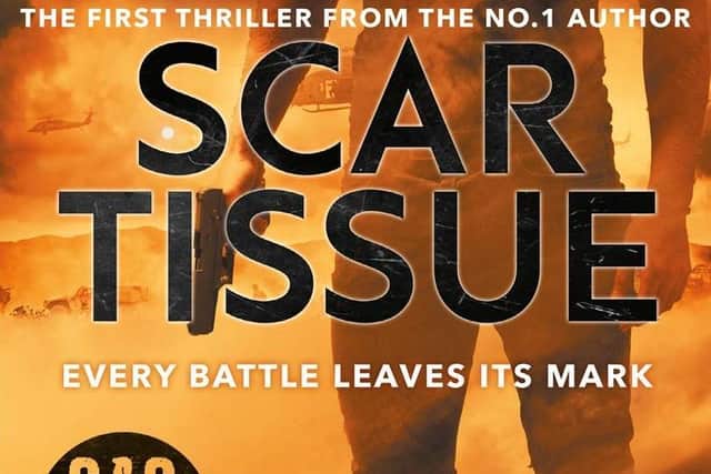 Scar Tissue