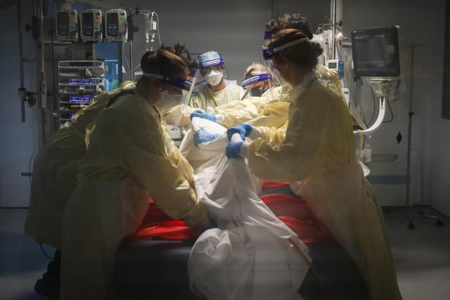 ICU staff put a patient into a 'reverse prone'