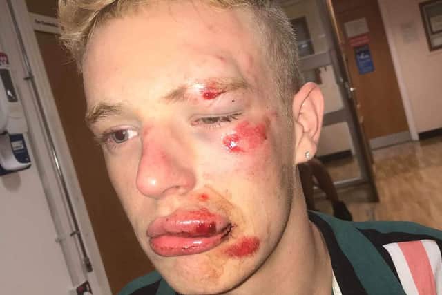 The sickening hate crime on Ryan was first reported by the Lancashire Post in 2019 and led to outrage on by gay rights campaign group, Stonewall