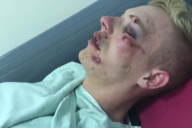Ryan was attacked outside a McDonald's drive-thru