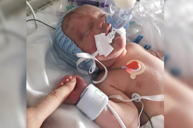 Louis, who had Congenital Diaphragmatic Hernia, passed away only one day old.