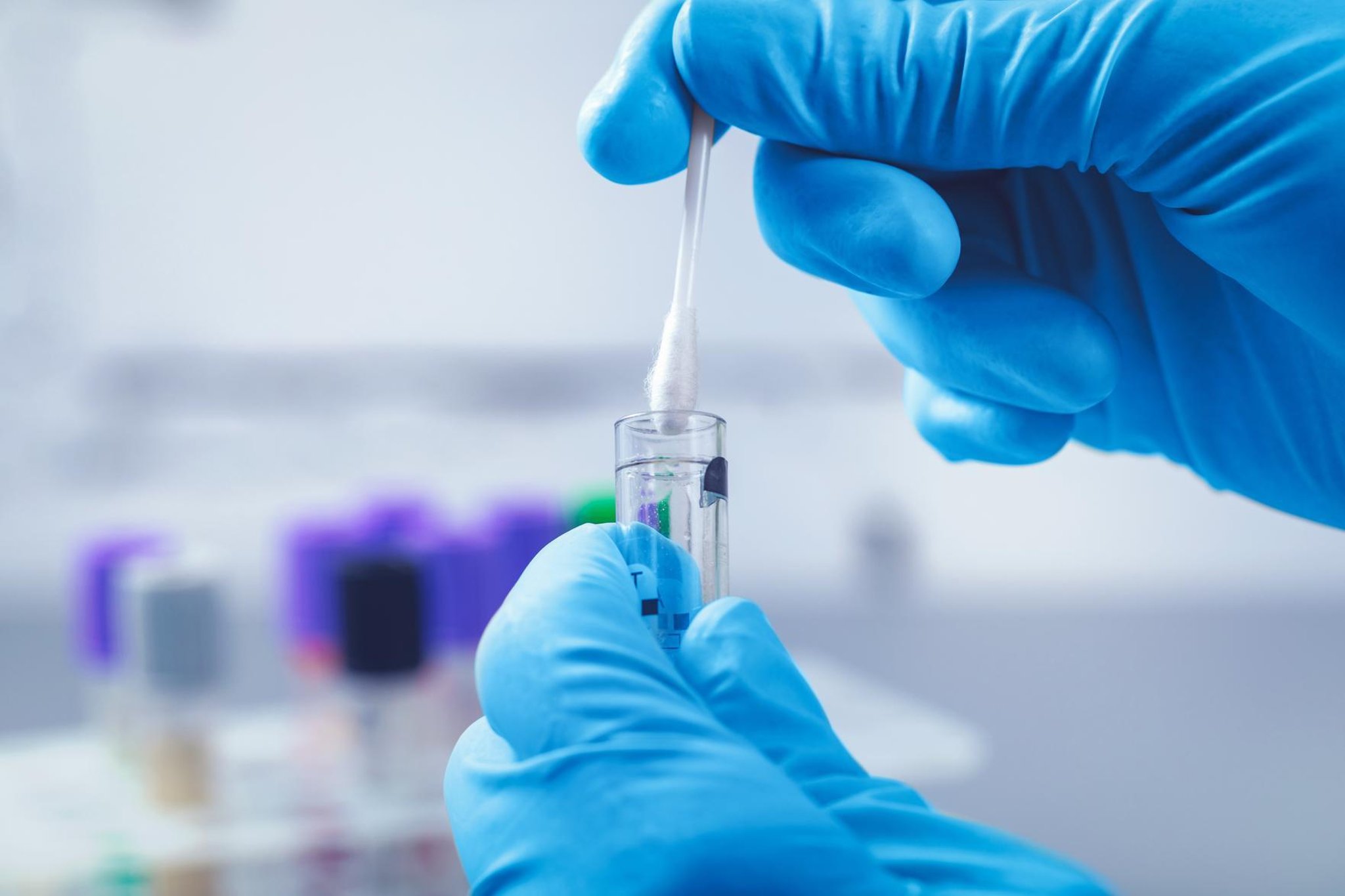 Revealed: how many people caught STIs in Preston as ‘super gonorrhoea’ spreads