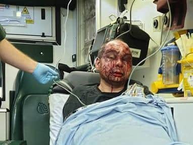 Officers said he is "lucky to be alive" following the horrific attack. (Credit: Lancashire Police)