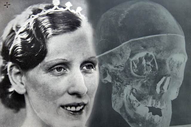 Photo of murder victim Isabella Ruxton next to photo of one of the skulls of Buck Ruxton’s victims