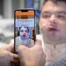 Nathan Armstrong, from Oswaldtwistle near Blackburn, has suffered from paralysis of his vocal cords since he was a child. He used the lipreading SRAVI app while in hospital.