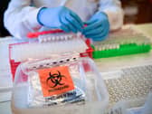 Covid-19: 99,470 people have had coronavirus in Lancashire