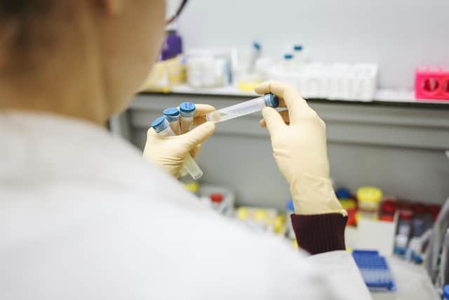 Scammers are offering PCR tests for the Omicron variant, which was named days ago (Photo by Polina Tankilevitch)