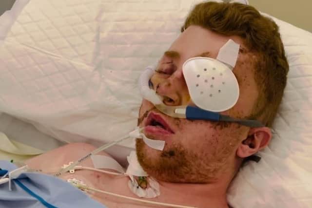 Josh Richardson, 24, from Chorley is currently in intensive care at a hospital in Bangkok after a horrific motorcycle crash left him needing a ventilator which he has just recently come off. He is now in need of funding for medical treatment and a GoFundMe has been set up to help