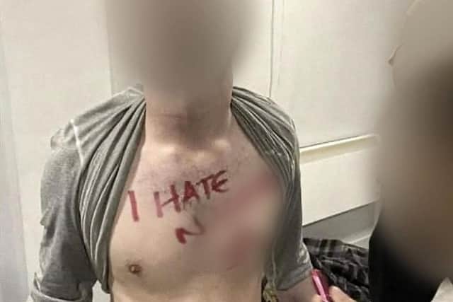 The University of Central Lancashire student has refused to apologise for the Swastika and racial slur written across his chest during a drinking game
