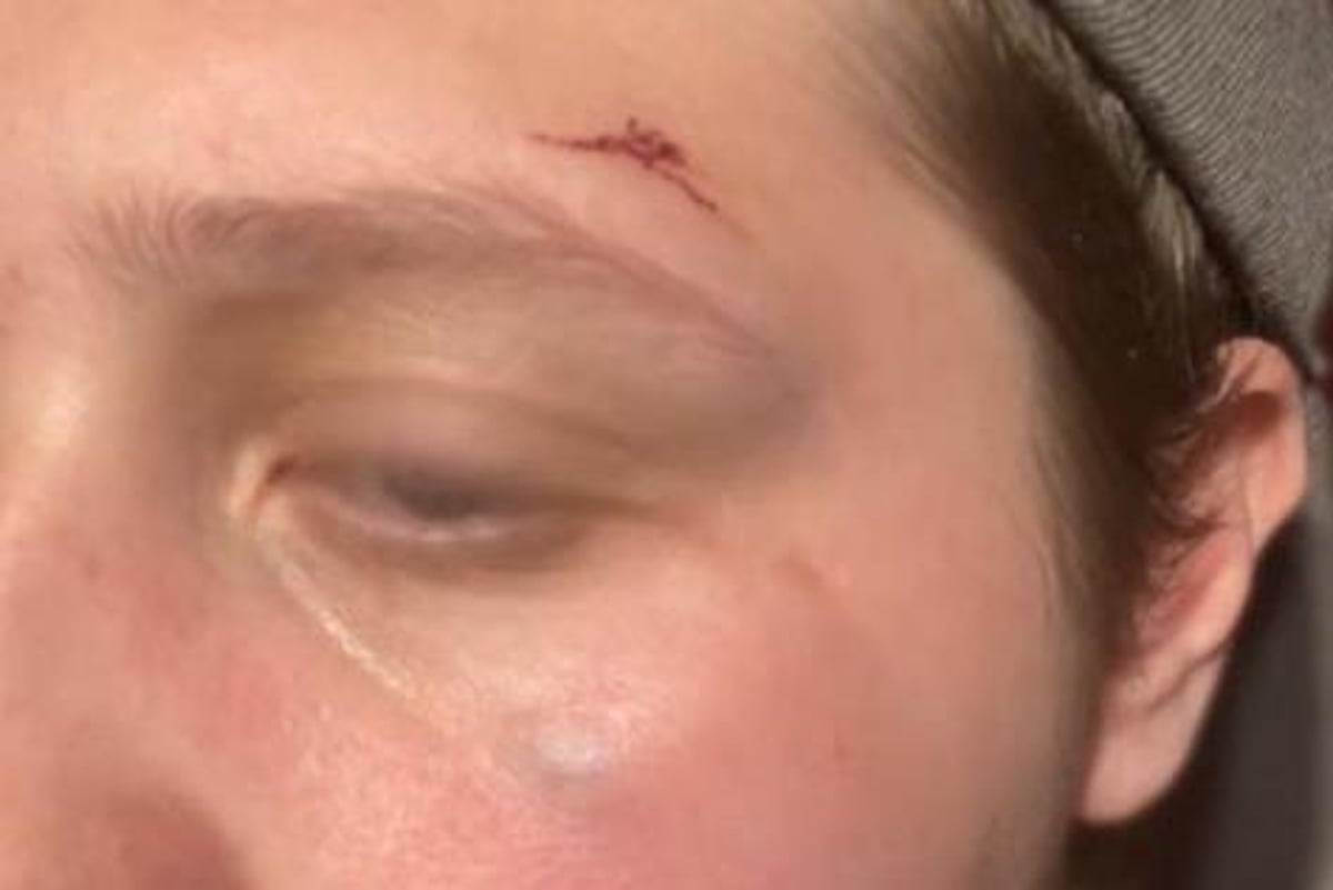 Preston woman robbed while having a seizure now too scared to leave her room