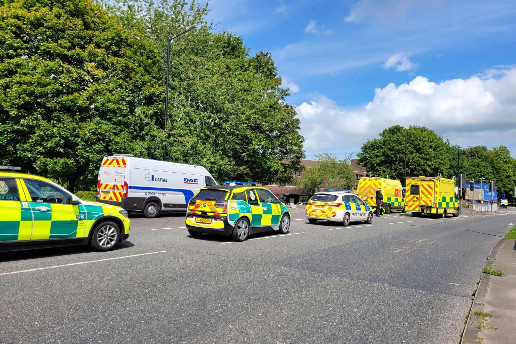 Woman suffers head injury after being hit by wagon in Lancaster