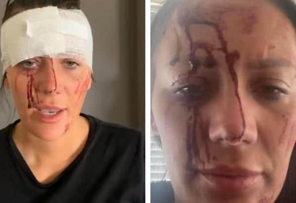 The family of Kiena Dawes released these images of the 23-year-old and claimed she suffered a number of violent assaults