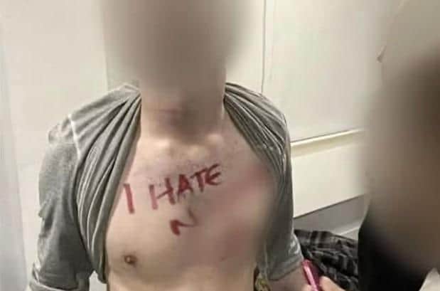 A University of Central Lancashire student was pictured with a Swastika and racial slur written across his chest during a drinking game