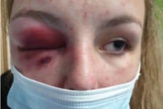 Liar: The Fake Grooming Scandal. From police evidence - Ellie's injuries.